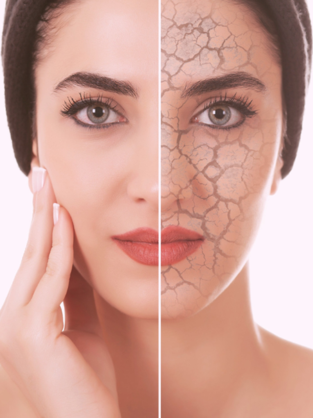 Advice For Treating Summer’s Dry Skin